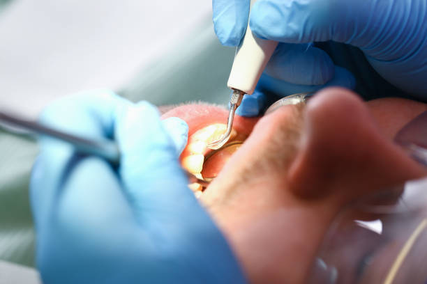 Best Weekend Emergency Dentist in Mountain View, HI