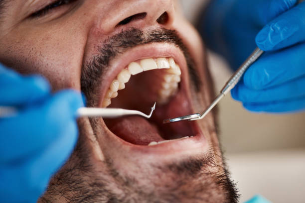 Best 24-Hour Emergency Dentist in Mountain View, HI