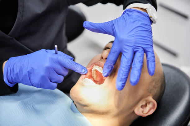 Best Emergency Wisdom Teeth Removal in Mountain View, HI