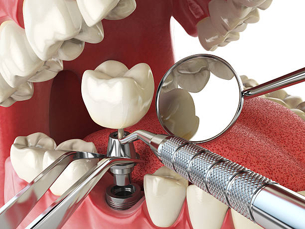 Best Emergency Dental Surgery in Mountain View, HI