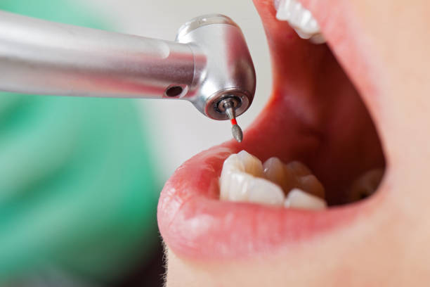 Best Emergency Treatment for Toothache in Mountain View, HI